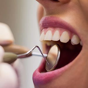 Fights tooth decay
